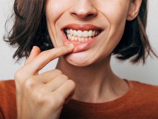 Lady shows gums